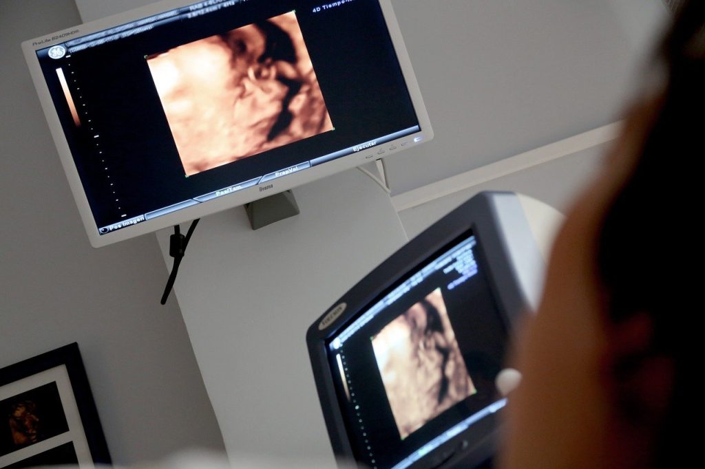 Pracownia RTG i USG: Kluczowe Aspekty Diagnostyki Obrazowej w Służbie Rehabilitacji