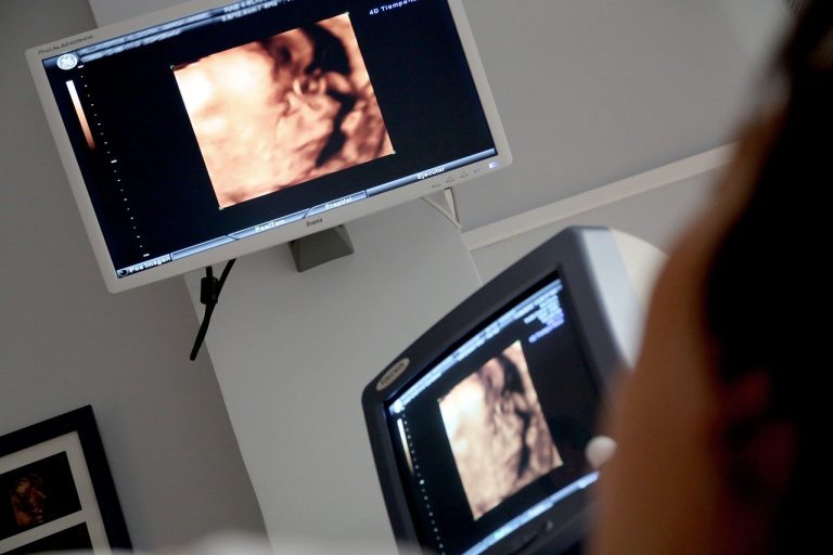 Pracownia RTG i USG: Kluczowe Aspekty Diagnostyki Obrazowej w Służbie Rehabilitacji